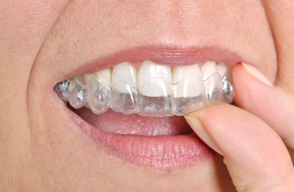 John Orthodontics | Coral Springs Invisalign | Parkland Invisalign | Coconut Creek Invisalign | Boca Raton Invisalign